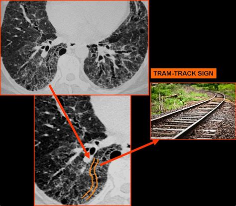 Tram Track Appearance