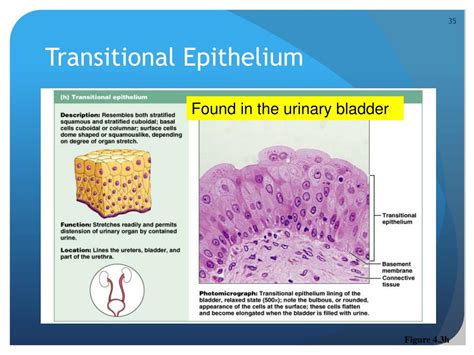 Transitional Epithelium Is Found