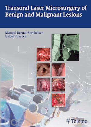 transoral laser microsurgery of benign and malign
