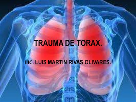 Trauma De Torax