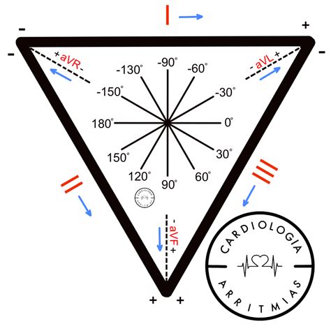Triangulo De Einthoven
