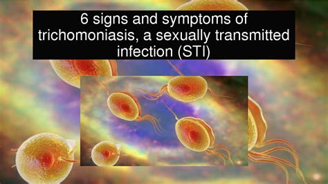 trichomoniasis how is it transmitted
