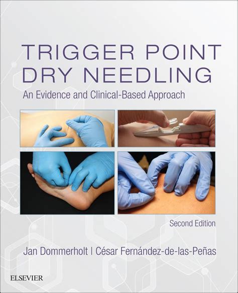 Read Trigger Point Dry Needling An Evidence And Clinical Based Approach 1E 1St First By Dommerholt Pt Dpt Faapm Jan Fernandez De Las Penas Pt Do 2013 Hardcover 