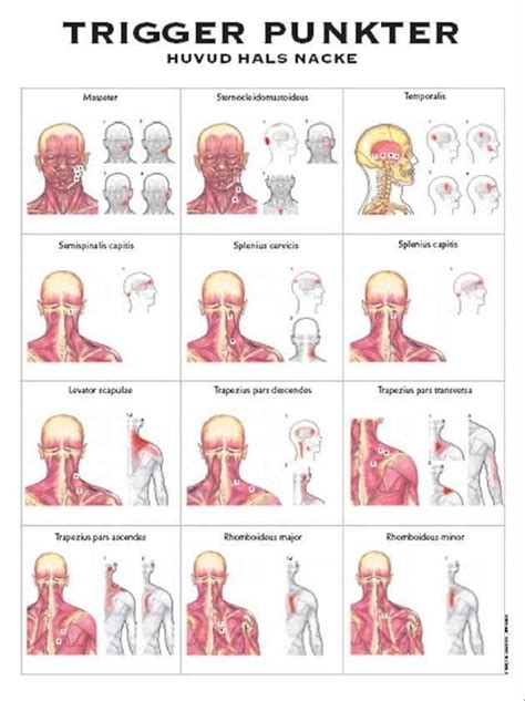 triggerpunkter ansiktet