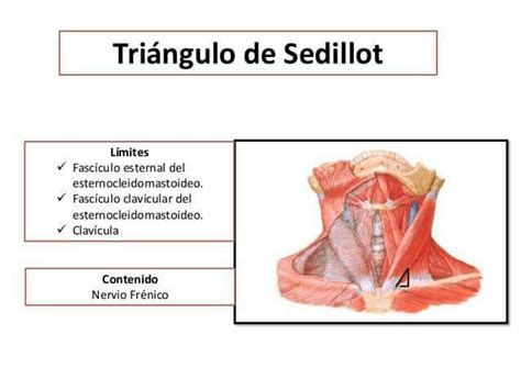 Triángulo De Sedillot