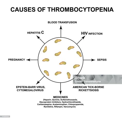 trombositopenia