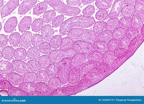 Ts Of Testis Under Microscope