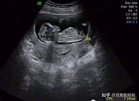 National Customer Service Week 2021 Roundup ⋆ Institute of Customer Service