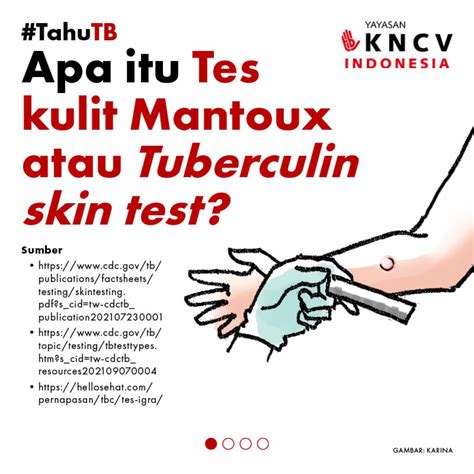 tuberkulin adalah
