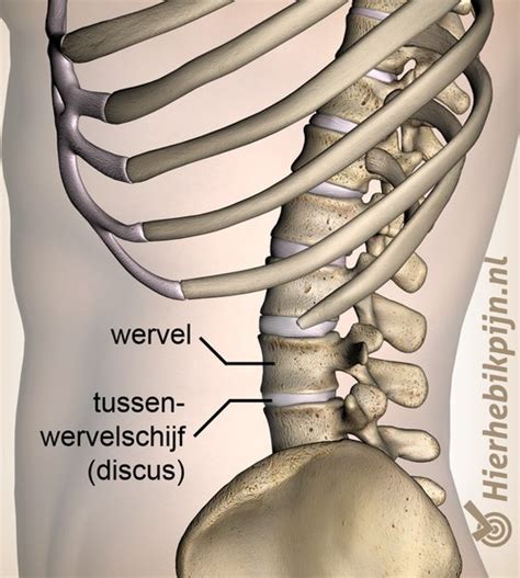 tussenwervelschijf