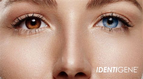 two different eye colors