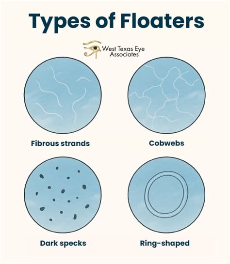 Types Of Eye Floaters And What They Mean