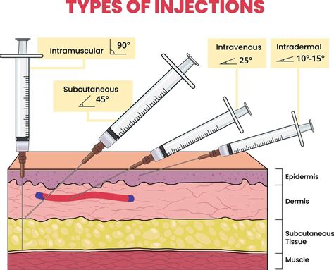 Types Of Injection