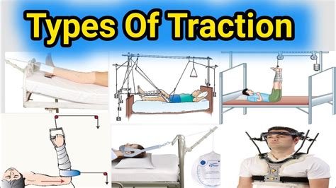 Types Of Traction