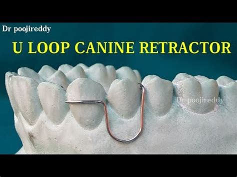 U Loop Canine Retractor