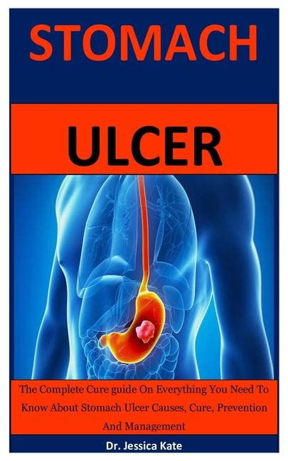 Ulcer A Complete Guide To Ulcers Including Ulcer Symptomsulcer Causesulcer Dietulcer Herbal Remedies For Treating Ulcers