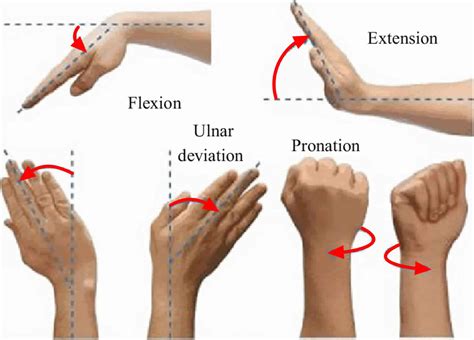 Ulnar Flexion