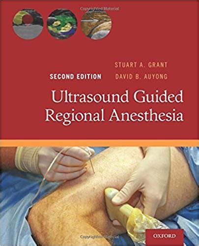 Read Online Ultrasound Guided Regional Anesthesia Stuart A Grant File Type Pdf 