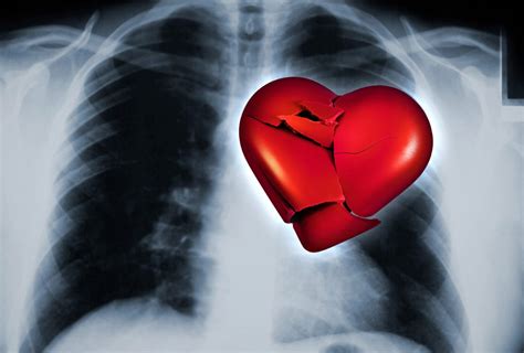 Un Corazon Roto