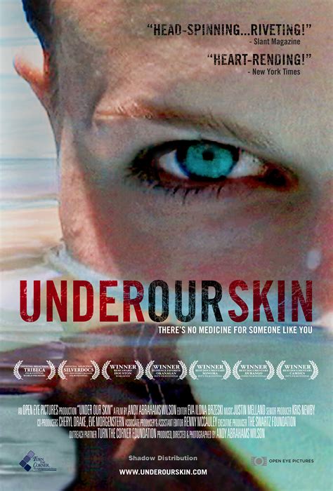 Full Download Under Our Skin Documentary Online 