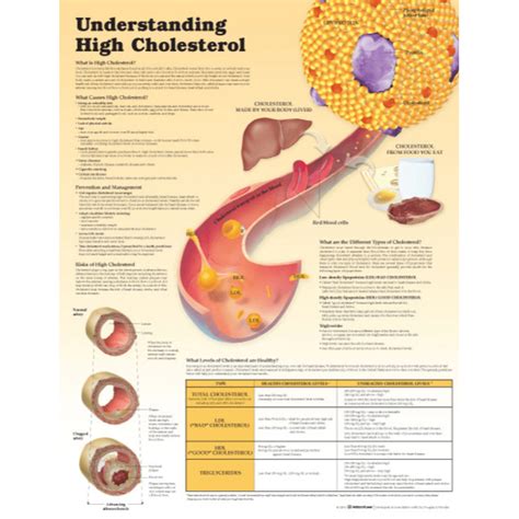 Understanding High Cholesterol Paper