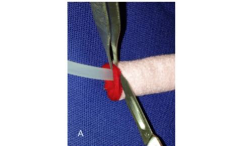 Urethral Prolapse Dog