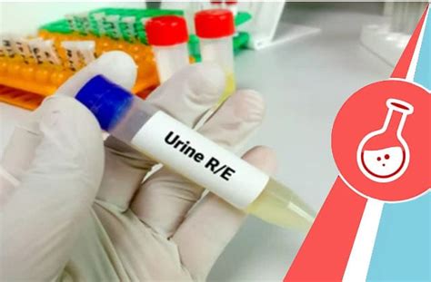 Urine Rm Test