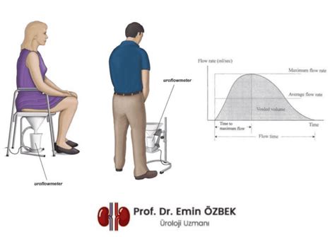 Uroflowmetry Test Price