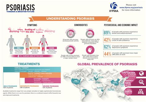 Useful Information On Psoriasis