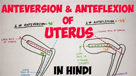 Utero Em Anteversoflexão