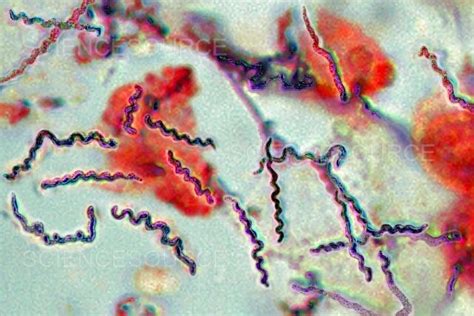 utläkt borrelia