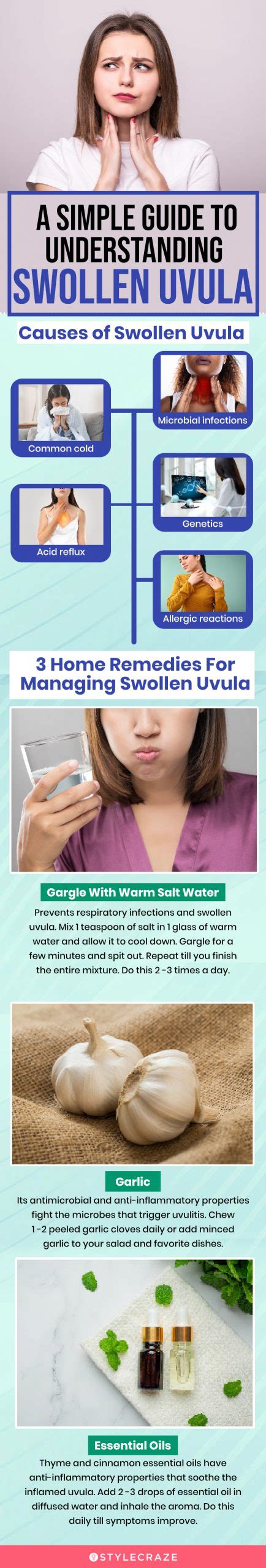 Full Download Uvula Ulcer Manual Guide 