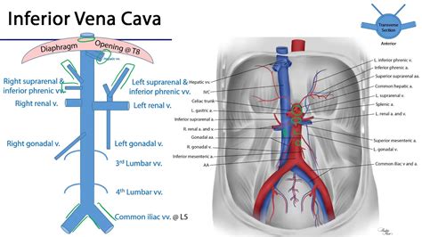 V Cava Inferior