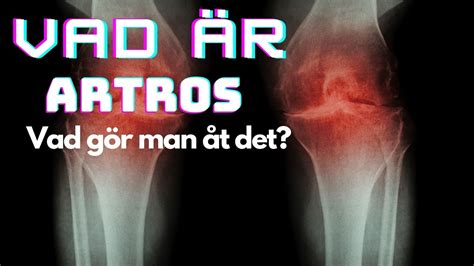 vad är posttraumatisk artros