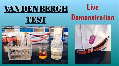 Van Den Bergh Test