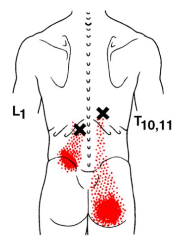 var sitter antagonisterna till hamstrings