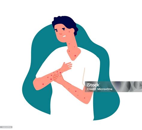 vattkoppor vuxen symptom