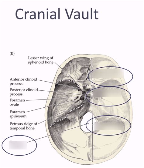 Vault Of Skull