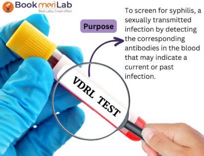 vdrl test is used to detect