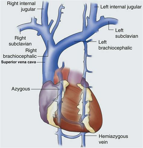 Vena Cava Superiore