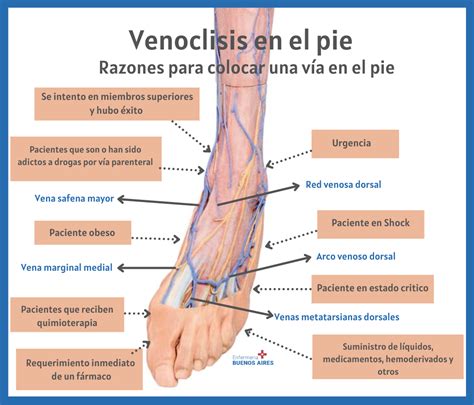 Venas Del Pie