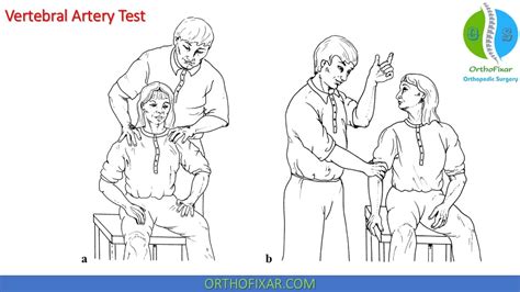 Vertebral Artery Test