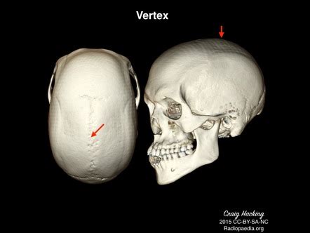 vertex of skull definition