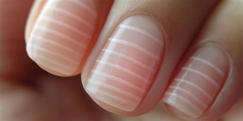 verticale strepen nagels