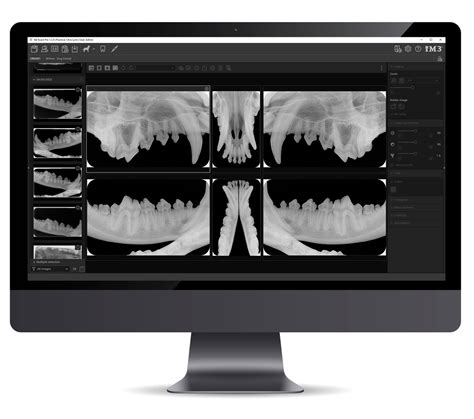 veterinary dental radiography software