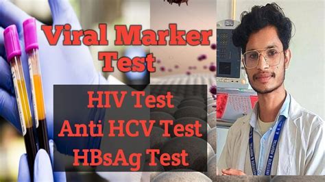 Viral Marker Test