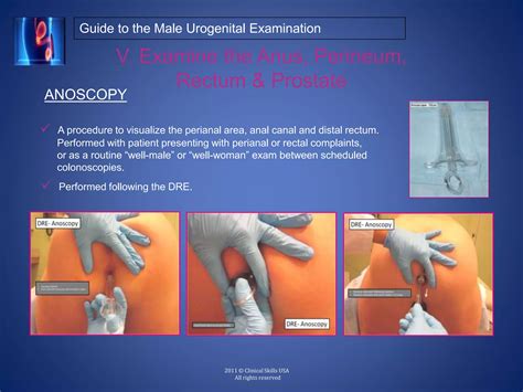 Visual Examination Of The Anus And Rectum Called