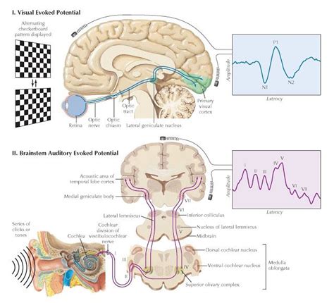 Full Download Visual Evoked Potential And Brainstem Auditory Evoked 