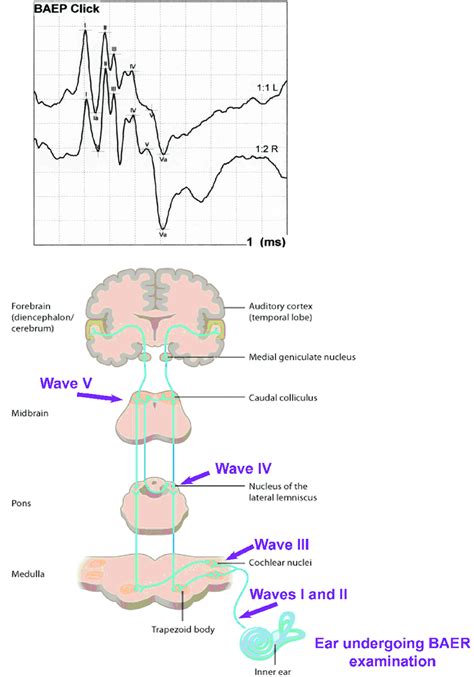 Read Online Visual Evoked Potential And Brainstem Auditory Evoked 
