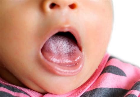 vit tunga bebis
